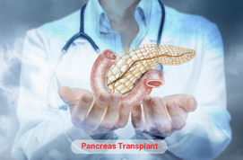 Pancreas Transplant