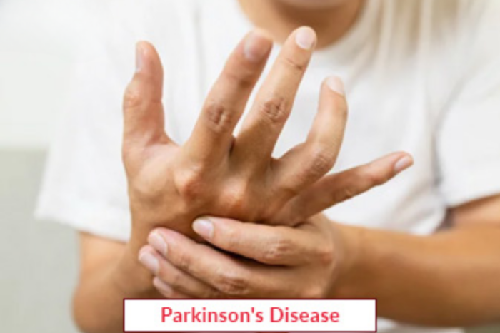 Parkinson’s Treatment