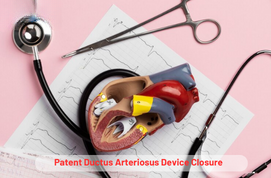 Patent Ductus Arteriosus Device Closure