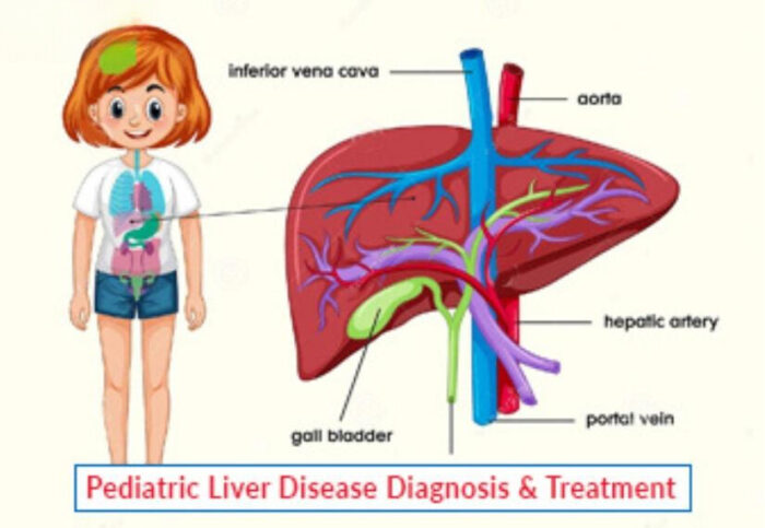 Pediatric Liver Disease