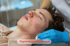 Pigmentation Treatment