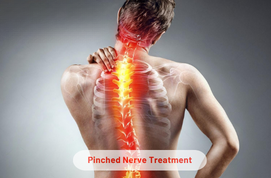 Pinched Nerve Treatment