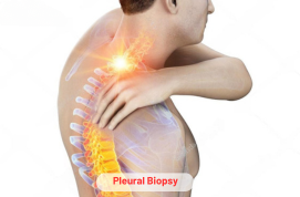 Pleural Biopsy