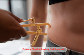 Primary Obesity Surgery Endolumenal