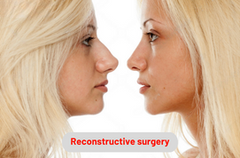 Reconstructive surgery