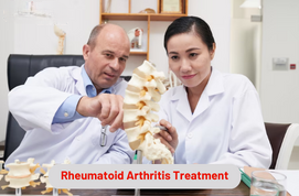 Rheumatoid Arthritis Treatment