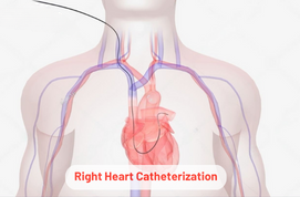 Right Heart Catheterization