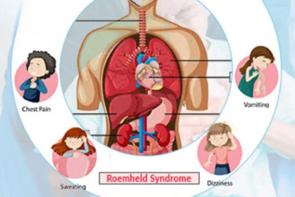 Roemheld Syndrome