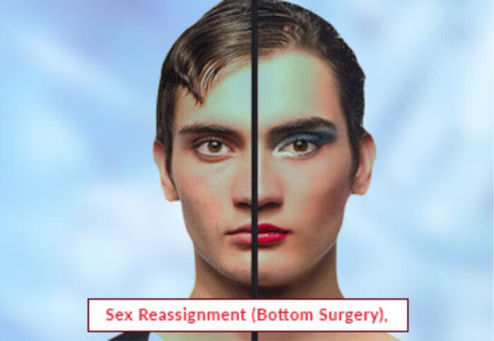 Sex Reassignment Surgery