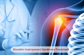 Shoulder Impingement Syndrome Treatment