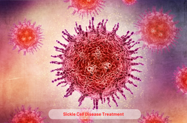 Sickle Cell Disease Treatment