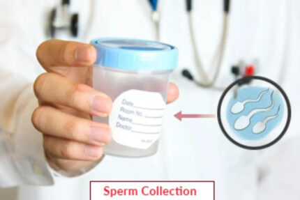 Sperm Collection