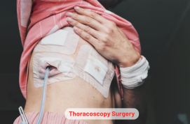 Thoracoscopy Surgery