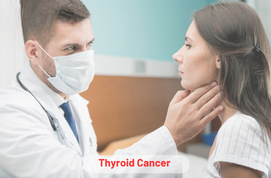 Thyroid Cancer