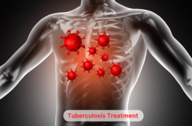 Tuberculosis Treatment