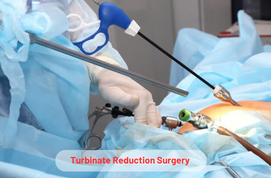 Turbinate Reduction Surgery