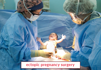 ectopic-pregnancy-surgery