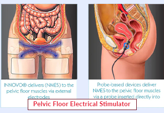 Pelvic Floor Electrical Stimulator