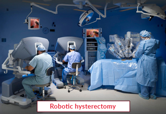 Robotic hysterectomy