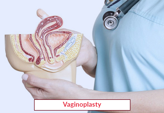 Vaginoplasty