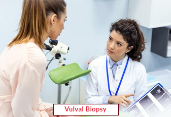 Vulval Biopsy