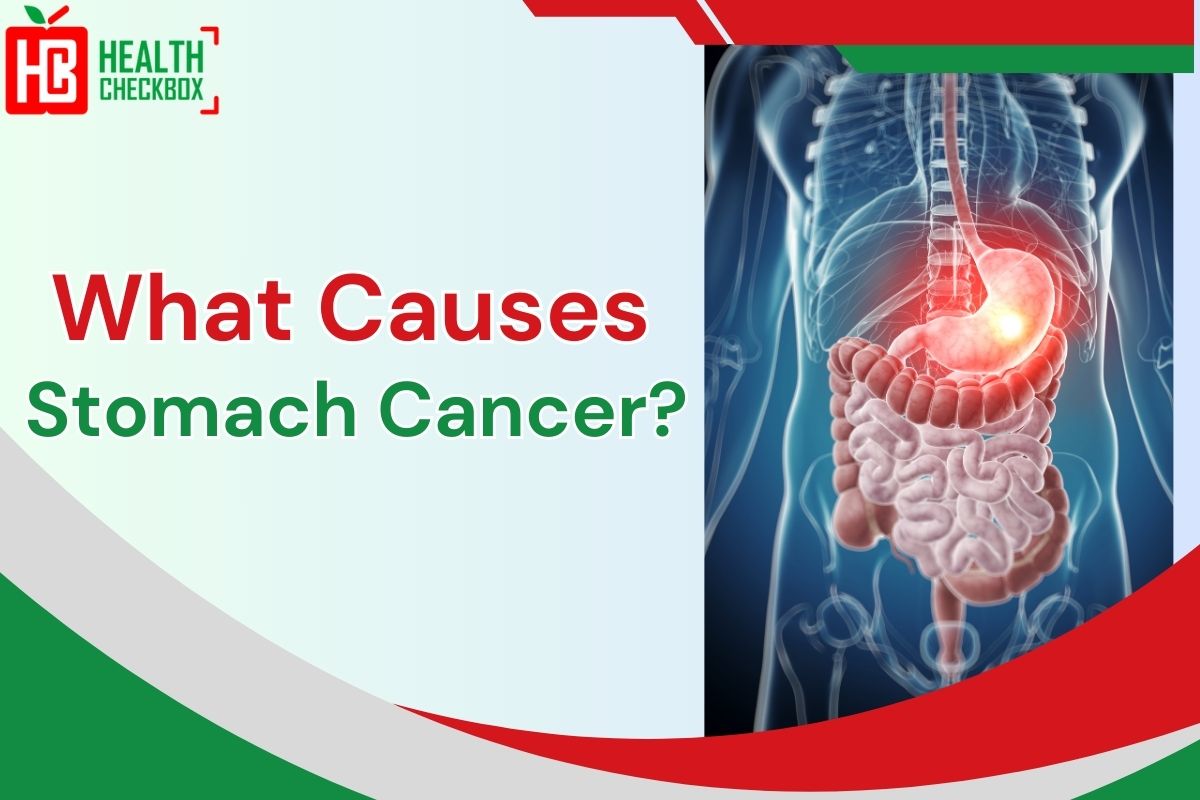 What Causes Stomach Cancer?