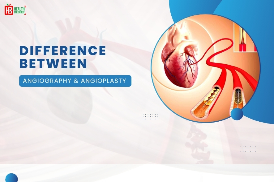 Angiography and Angioplasty blog img