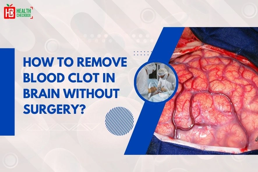 How to Remove Blood Clot in Brain Without Surgery blog img