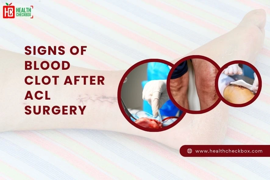 Signs of Blood Clot After ACL Surgery blog-image