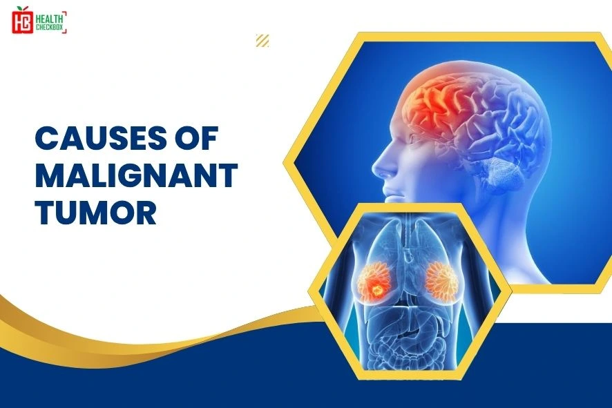 Causes of Malignant Tumor blog-img