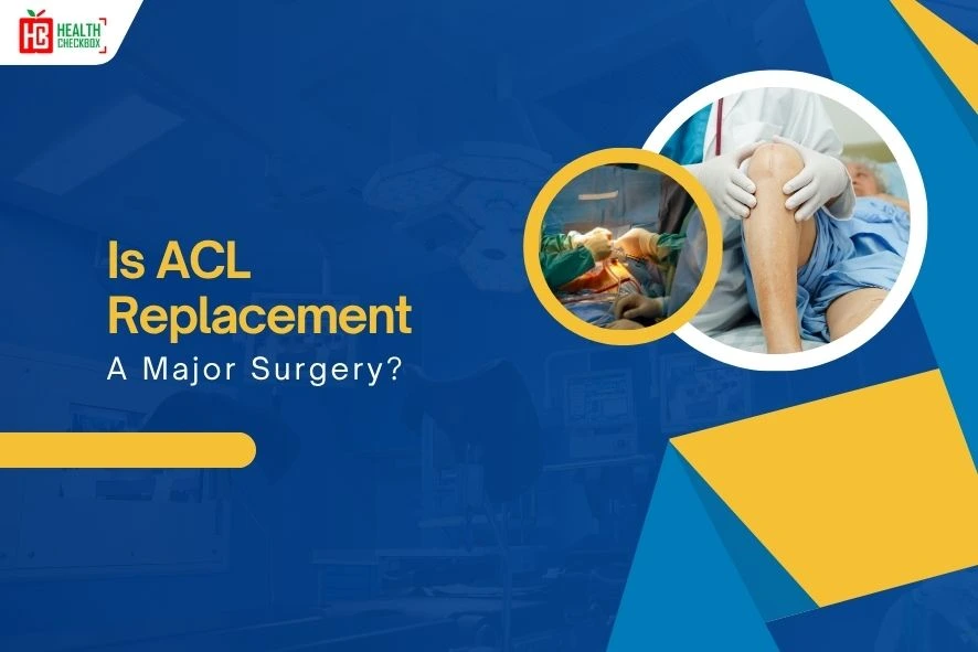 Is ACL Replacement a Major Surgery blog-img
