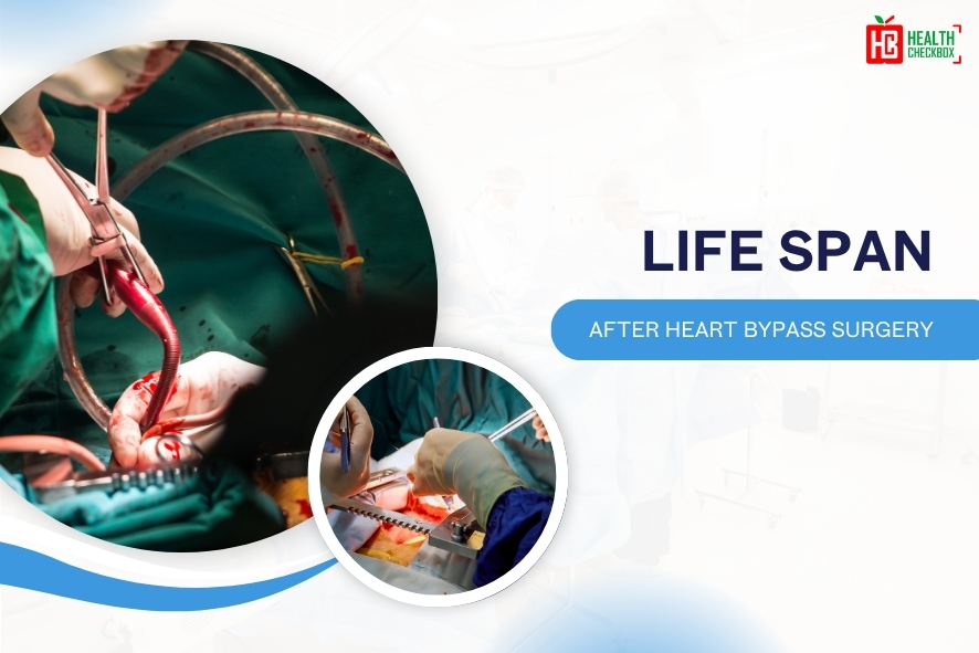 Life Span After Heart Bypass Surgery-blog img