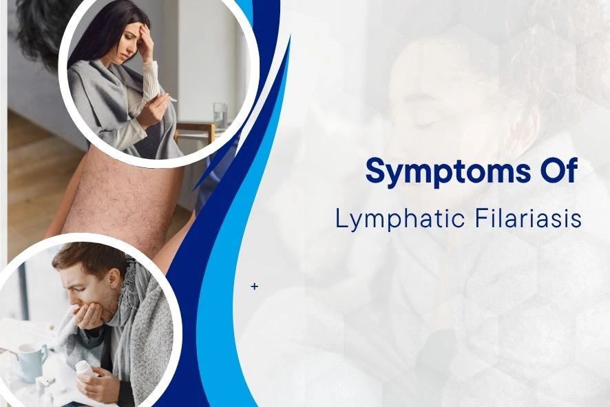 Symptoms of Lymphatic Filariasis blog-img
