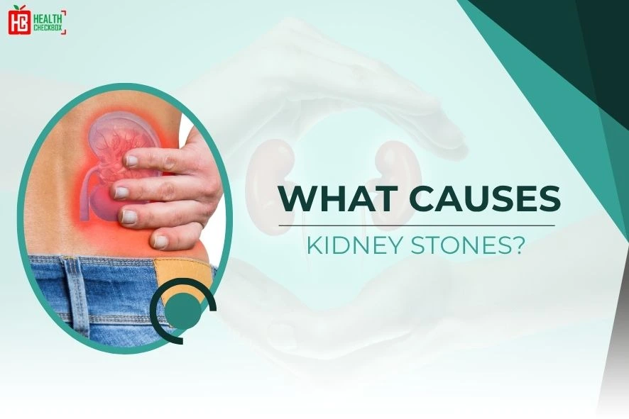 What Causes Kidney Stones blog-img