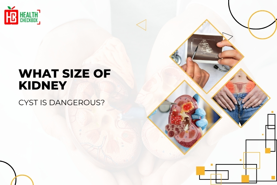 What Size of Kidney Cyst is Dangerous-blog-img