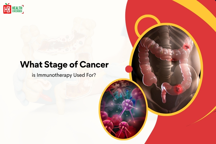 What Stage of Cancer is Immunotherapy Used For-blog img