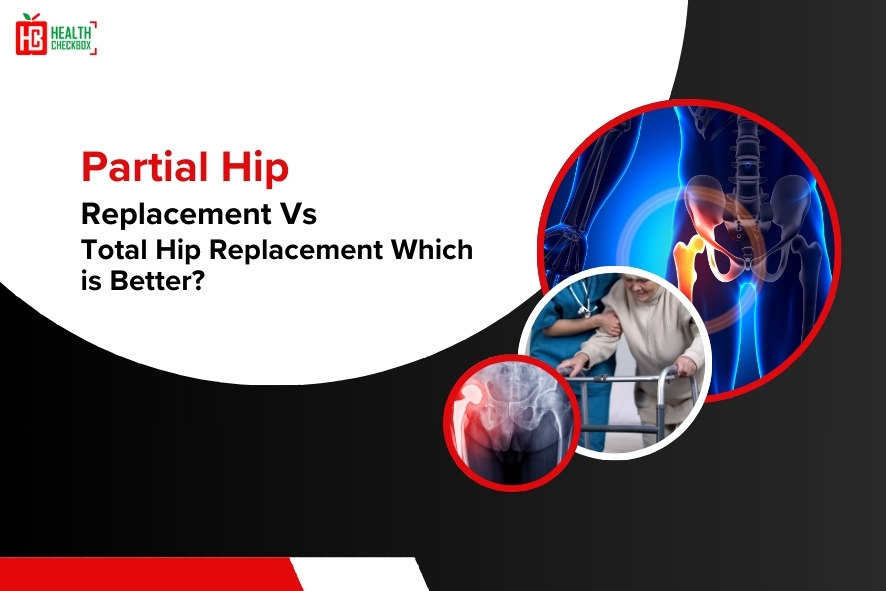 Partial Hip Replacement vs Total Hip Replacement-blog img