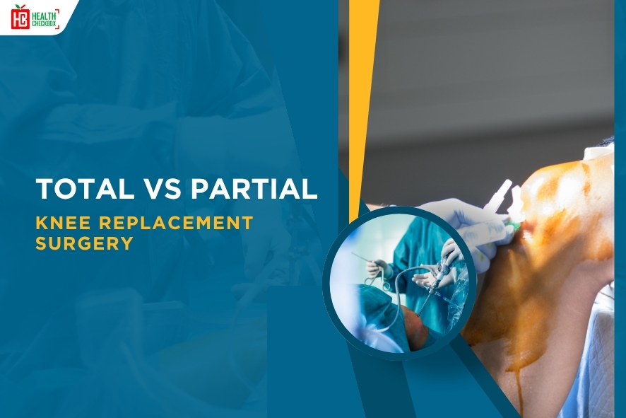 Total vs Partial Knee Replacement Surgery-blog img