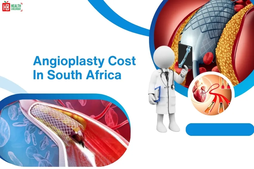 Cost of Angioplasty in South Africa-blog img