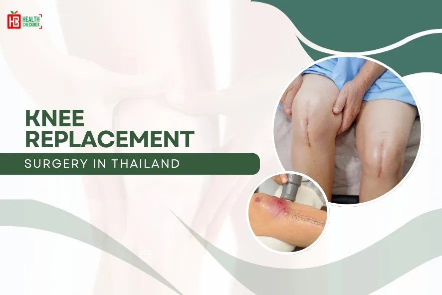 Knee Replacement Surgery in Thailand-blog img