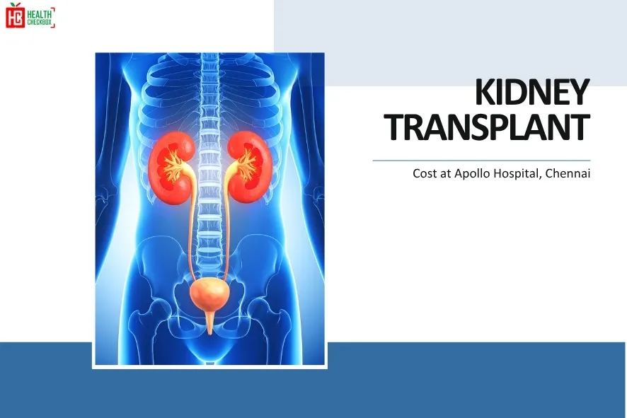 Kidney Transplant Cost in Apollo Hospital Chennai-blog img