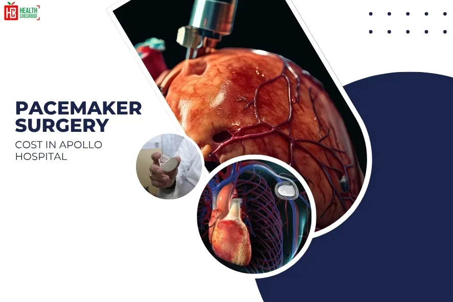 Pacemaker Surgery Cost in Apollo Hospital-blog img