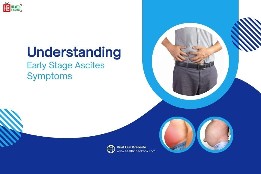 Early Stage Ascites Symptoms-blog img