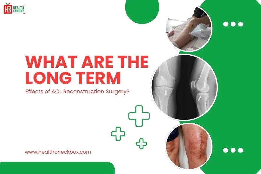Long Term Effects of ACL Reconstruction Surgery-blog img
