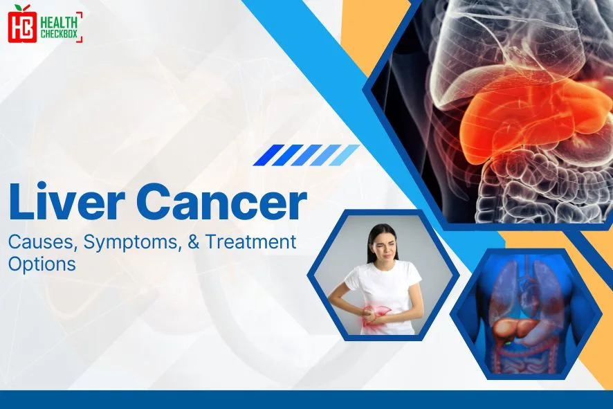 Liver Cancer Causes, Symptoms, & Treatment Options blog img