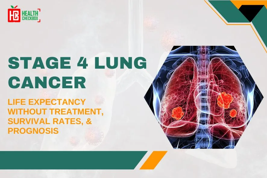 Stage 4 lung cancer life expectancy without treatment blog img